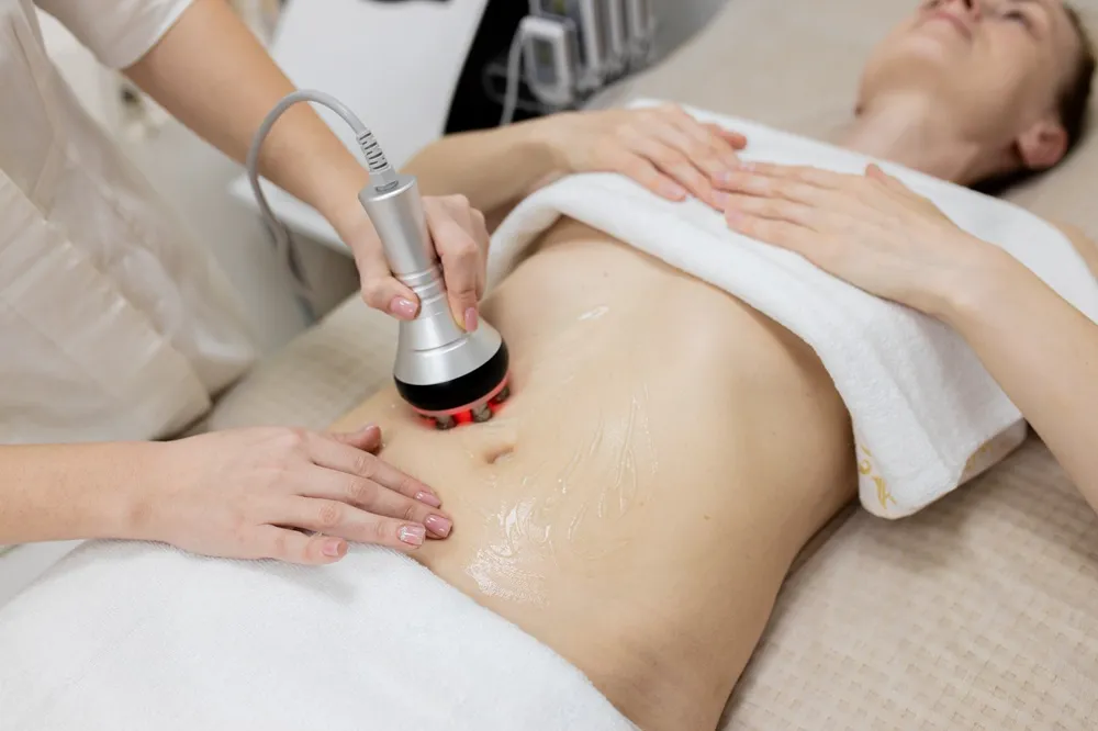 Cavitation with RF