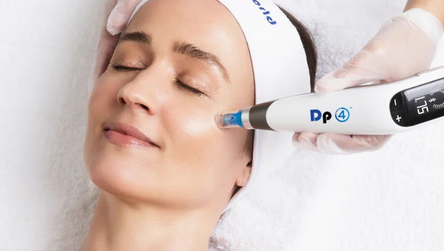 Microneedling Treatment In Harbor City CA