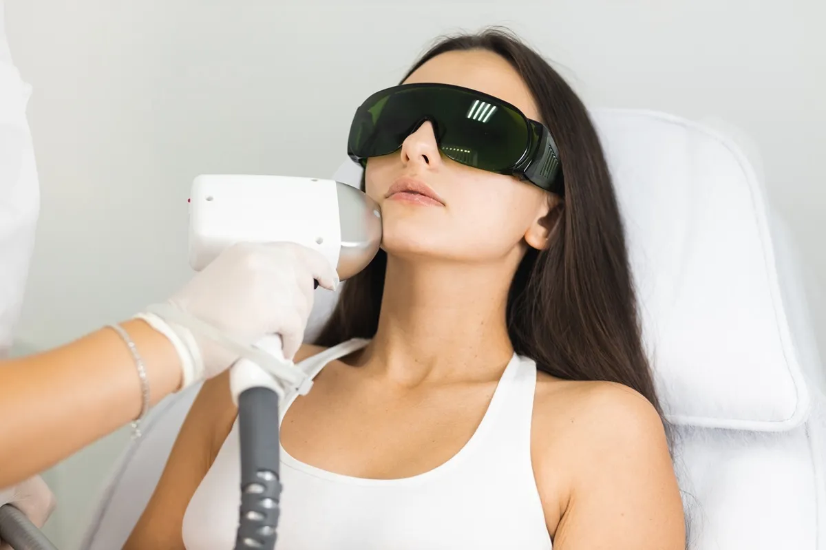 laser facial