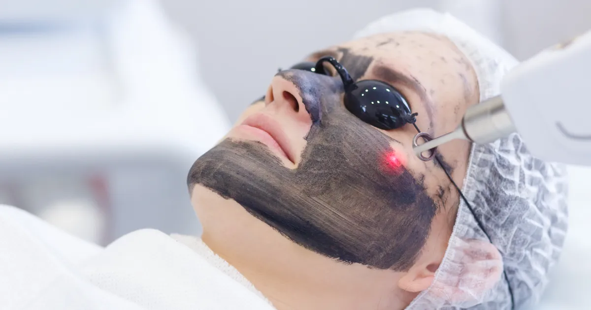 A woman receiving Carbon Doll Facial In Harbor City, CA