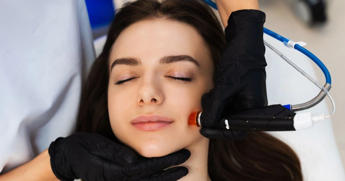 Close-up of the patented HydraFacial vortex-fusion tip used at Body Hub Med Spa.